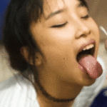 ngPMVH